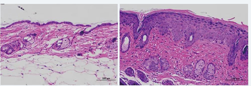 图9：嘧喹莫特致小鼠银屑病样皮肤病变.jpg