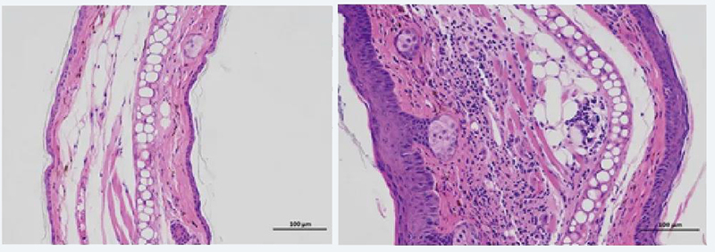 图10：IL-23-致小鼠银屑病样皮肤病变.jpg